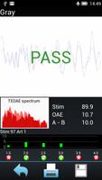 Audio-SMART