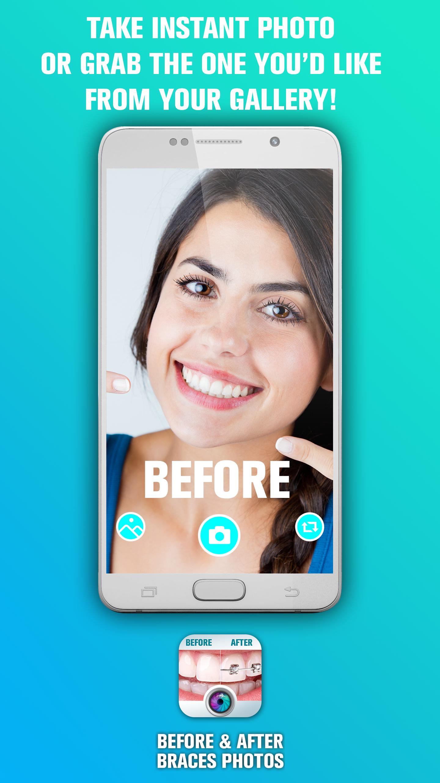Dental Braces Before And After