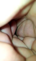 Otoscopio