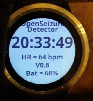 OpenSeizureDetector