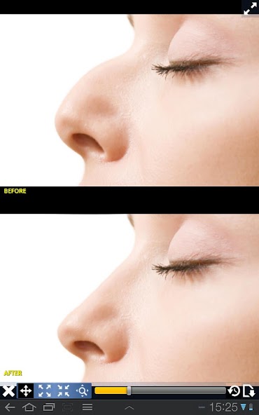 Plastic Surgery Simulator Lite