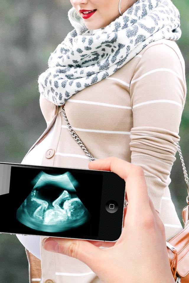Ultra Sound Scanner Prank