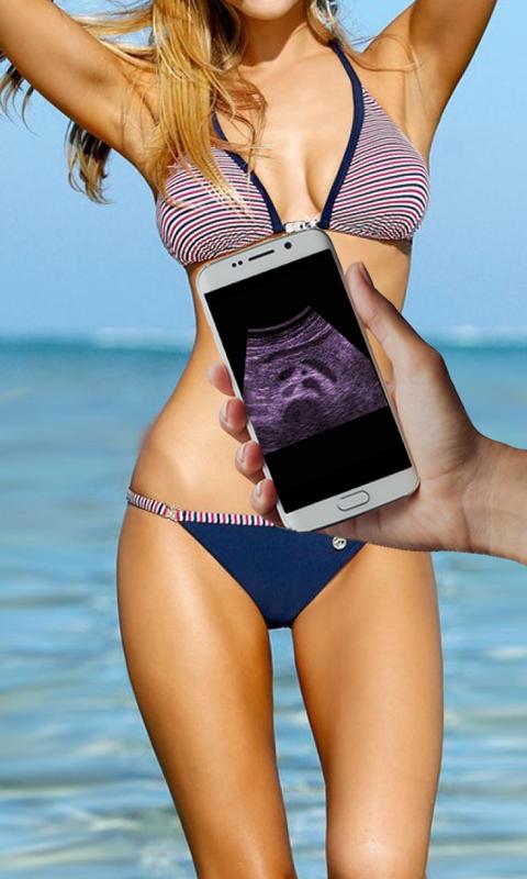 Ultrasound Scanner Prank